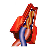 4035-WINGED-WIRE-CONNECTOR-GRAPH